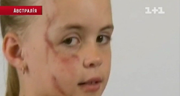 7-летнюю девочку едва не растоптал кенгуру