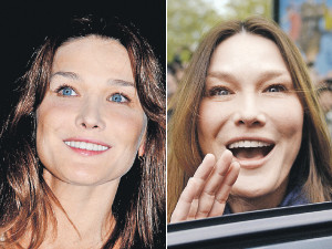 Карла шокировала французов своим лицом