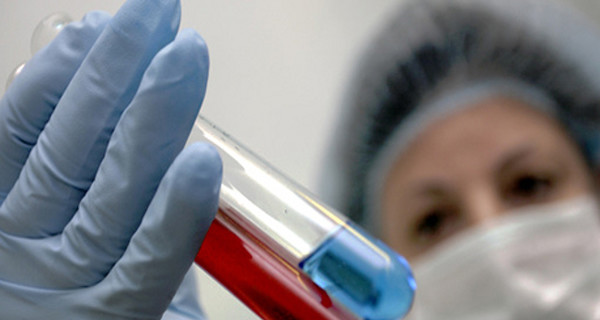 В КНДР зафиксировали вспышку птичьего гриппа