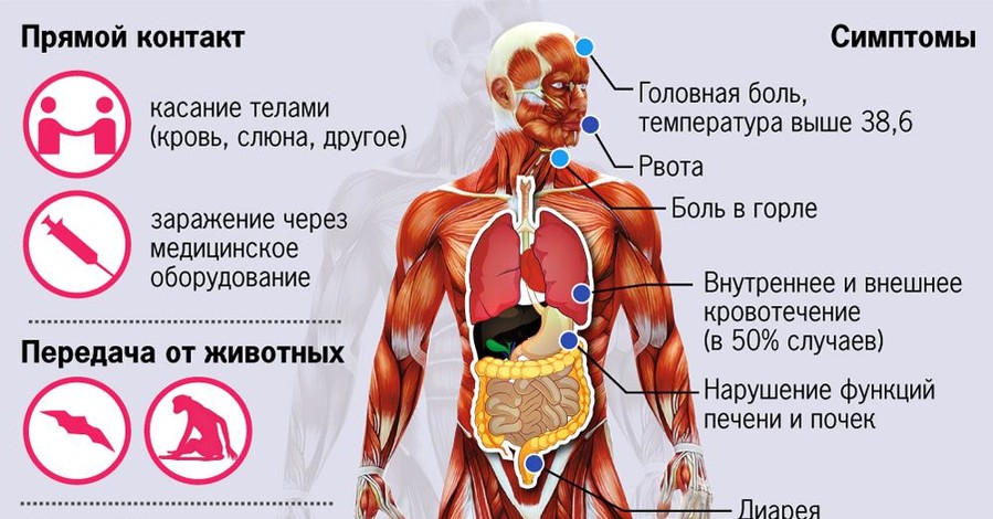 Вирус Эбола: признаки и пути заражения