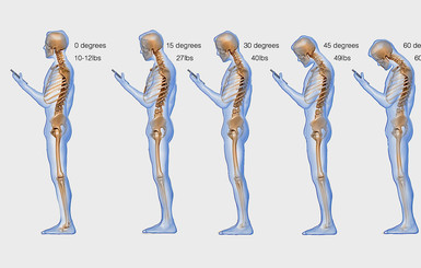 Доктора бьют тревогу: смартфоны приводят к заболеваниям позвоночника