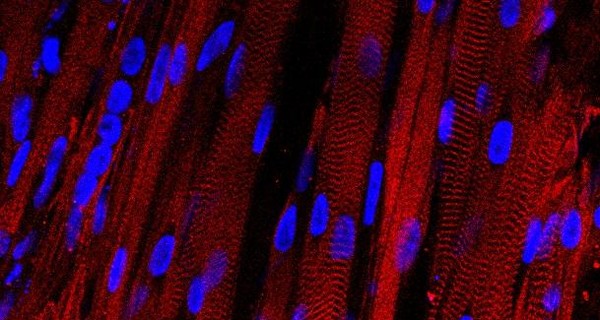 Сенсация в мире науки: ученые впервые вырастили человеческие мышцы