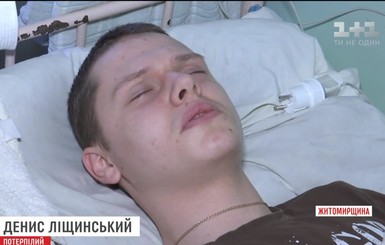 В Бердичеве 18-летнему парню сломали позвоночник в ночном клубе