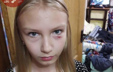 В Киеве пожилая женщина напала на 11-летнюю девочку и ее отца