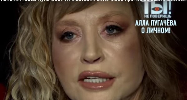 Пугачева - про свое новое лицо: Врачи мне запретили общий наркоз