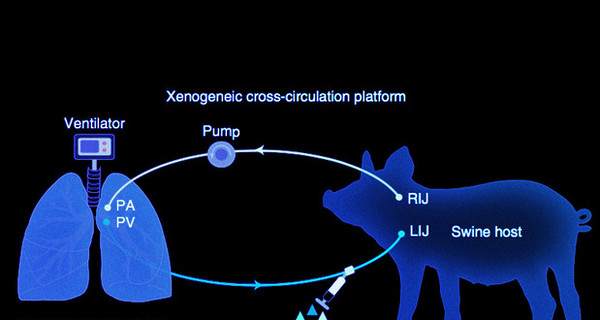 Ученые вылечили человеческие легкие, присоединив их к живой свинье