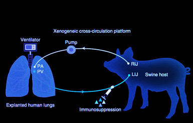 Ученые вылечили человеческие легкие, присоединив их к живой свинье