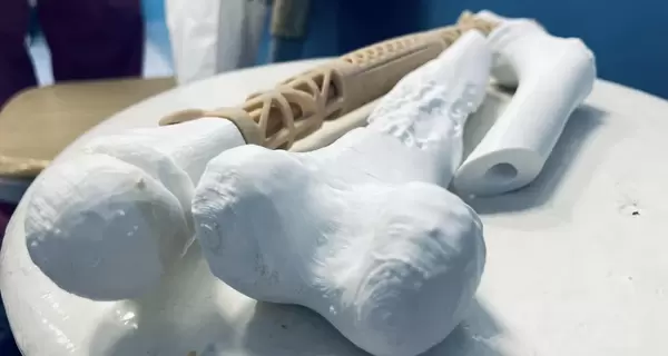 Ученая из КПИ печатает кости на 3D-принтере: длина имплантов достигает 40 сантиметров