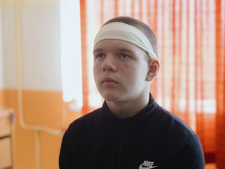 Під час удару по Сумах 13-річний поранений хлопець врятував людей з палаючого автобуса  
