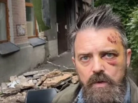 В Киеве на американского режиссера Кристофера Уолтерса упал балкон