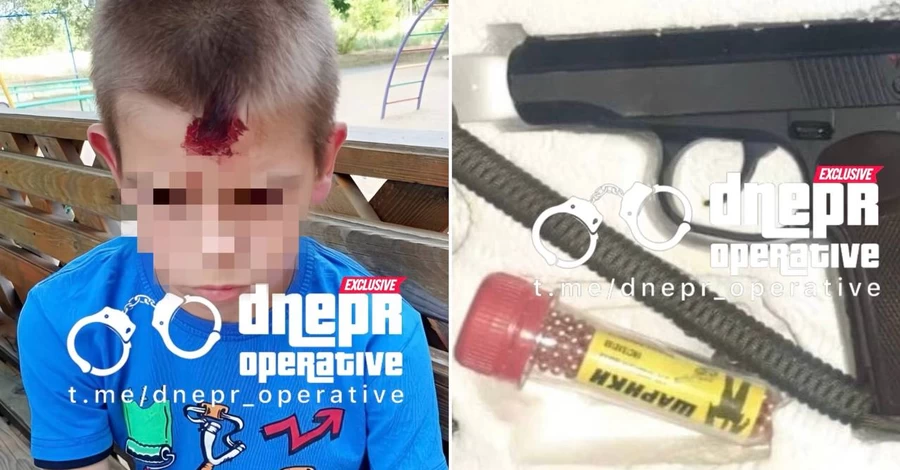 В Кривом Роге военный стрелял по детской площадке: ранен 10-летний мальчик 