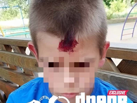 В Кривом Роге военный стрелял по детской площадке: ранен 10-летний мальчик 