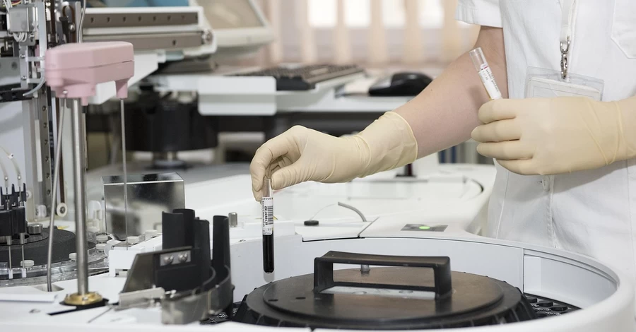 В Україні зафіксували спалах вірусу Коксакі - на Київщині захворіло 13 дітей