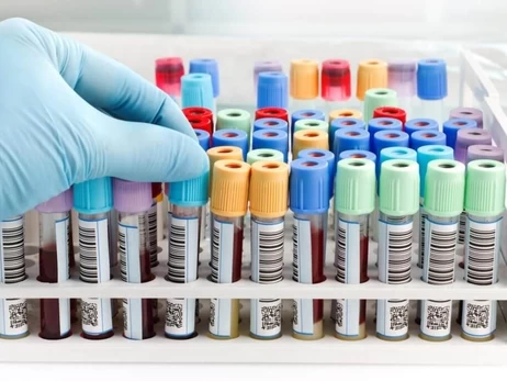 Из-за вспышки гепатита А на Закарпатье кое-где закрыли рестораны и кафе и ввели ограничения для туристов