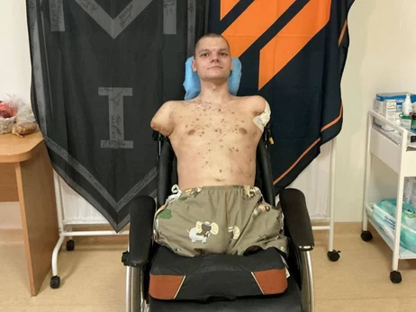 Приватбанк оплатить протезування ветерану, якому відмовили у оформленні картки