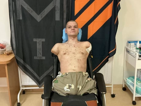 ПриватБанк відмовив ветерану без рук у переоформленні картки - втрутився голова НБУ