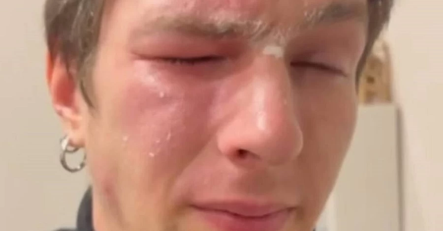 Во Львове из-за замечаний по мусору в подъезде облили перечным баллончиком ветерана войны