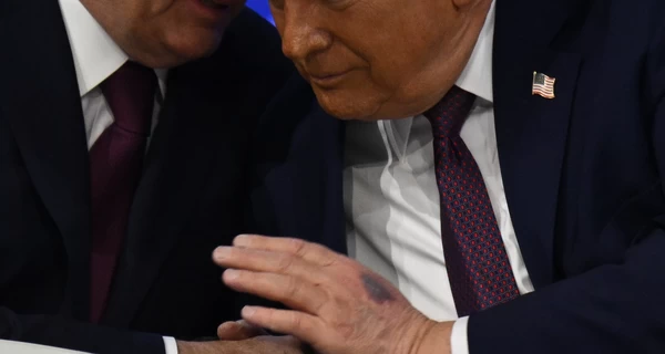 Трамп у Давосі пояснив походження синця на руці