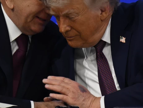 Трамп у Давосі пояснив походження синця на руці