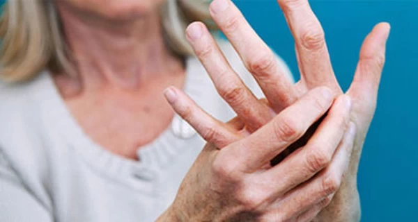 Чому болять суглоби: ревматолог пояснила, коли це норма, а коли - тривожний сигнал
