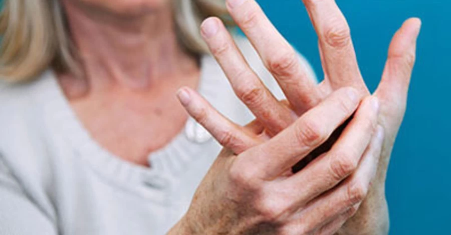 Чому болять суглоби: ревматолог пояснила, коли це норма, а коли - тривожний сигнал