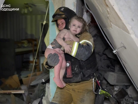 В Одессе из больницы выписали девочку, фото которой после обстрела разлетелось по сети