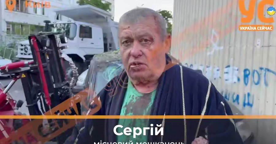 Пострадавший во время атаки РФ на Киев: Все горело, люди кричали